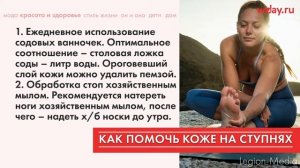 Почему кожа на ступнях шелушится, облезает?