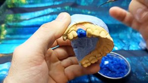 временные коронки, временные пластмассовые зубы, импланты