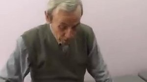 Удаление папиллом жидким азотом