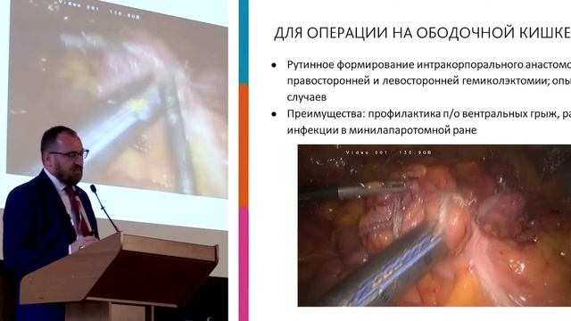 Черниковский И. Л. Совершенствование хирургической помощи больным с колоректальным раком смотреть онлайн