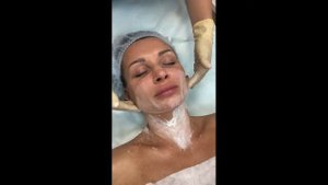 Портативный дарсонваль для лица Beautyfor | "Пластэк"