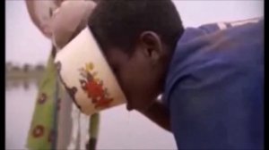 Dracunculus medinensis Parasitology Video