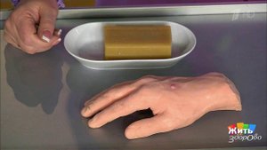 Необычное использование хозяйственного мыла. Жить здорово! Фрагмент выпуска от 06.12.2016