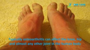 Understanding Arthritis treatment in Coimbatore