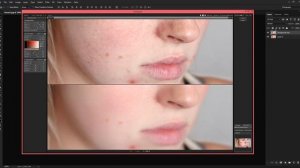 How To Remove Acne & Make Smooth Skin Using Portraiture In Photoshop CC (4K) || Surendra Devagan