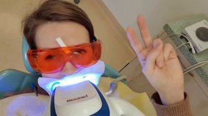 Отбеливание зубов по системе Beyond, сравнение до и после