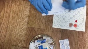 Определение  групп крови прямым методом с цоликлонами анти-А и анти-В