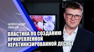 Пластика по созданию прикрепленной кератинизированной десны с использованием свободного лоскута