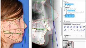 Диагностика и планирование ортодонтического лечения