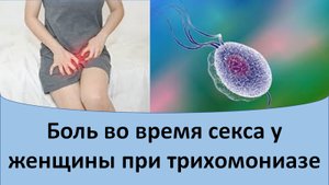 Боль во время секса у женщины при трихомониазе.