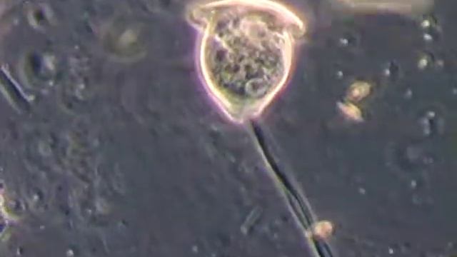 Vorticella campanula in activated sludge смотреть онлайн