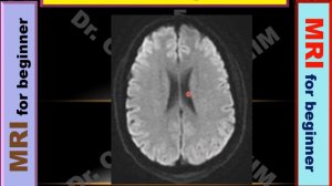 Brain MRI Sequences specific  (Level 3)