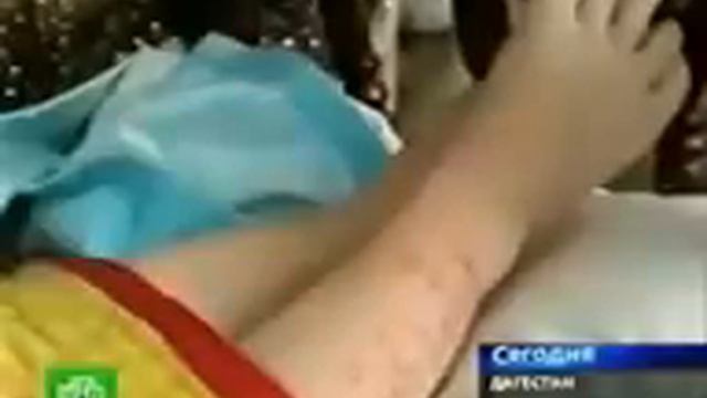 A .Miracles of Islam, Verses of Holy Quran Appeared on Skin of a 9 months old baby AMAZING!.3gp смотреть онлайн