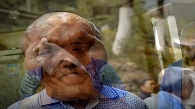 ЧЕЛОВЕК С ЛИЦОМ ИНОПЛАНЕТЯНИНА. Удивительные люди. Самая большая голова в мире. Интересные факты