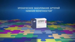 Сермион