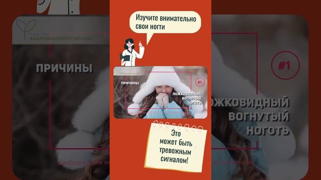 Вогнутые и половинные ногти расскажут о ваших проблемах со здоровьем