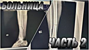 Что было в БОЛЬНИЦЕ!?||ПЕРЕЛОМ?\\ОПЕРАЦИЯ?