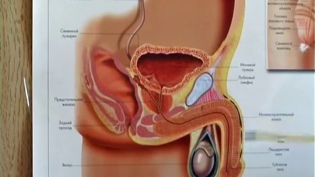 простатит смотреть онлайн