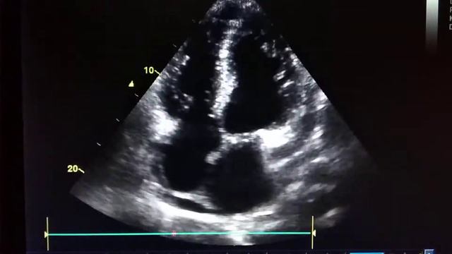 ДКМП смотреть онлайн