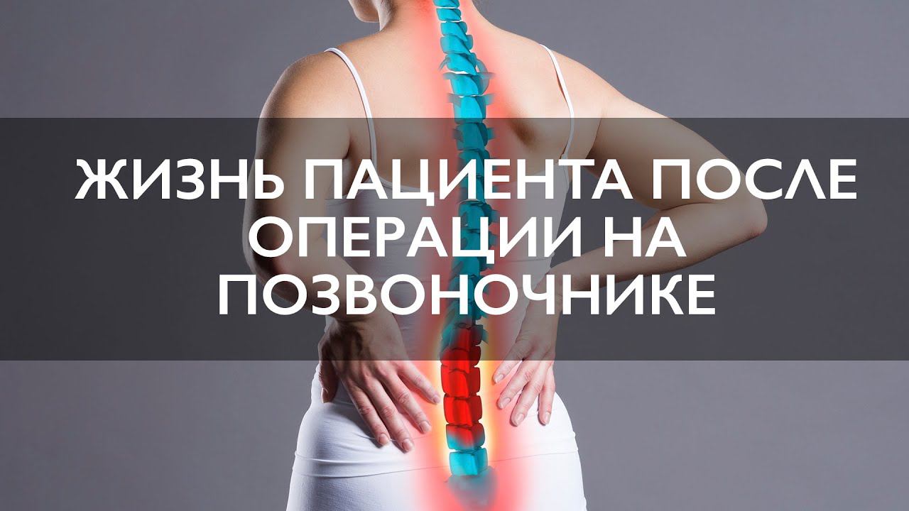 Лечение стеноза позвоночника | Жизнь пациента после операции