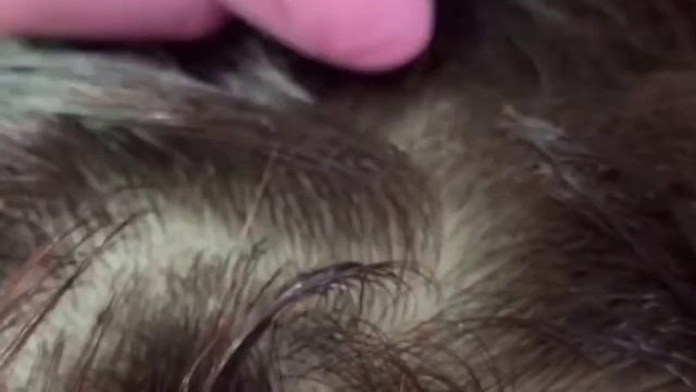 Соч токилишига карши витамин! | Витамин против выпадения волос! смотреть онлайн