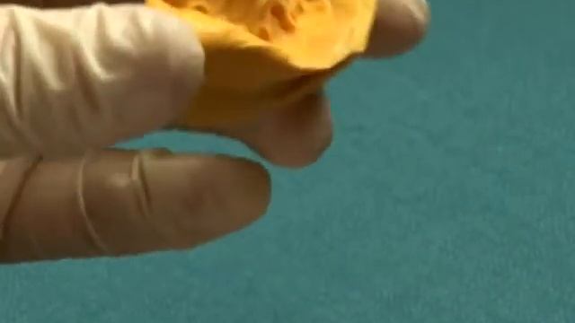 Коронки из нержавеющей стали.wmv смотреть онлайн