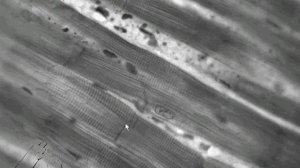 Поперечнополосатая #сердечная  мышечная ткань