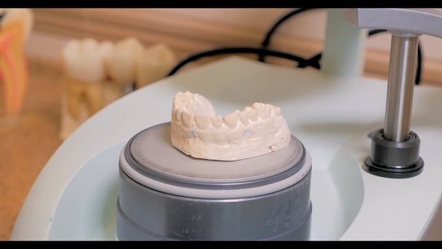 Индивидуальные спортивные капы смотреть онлайн