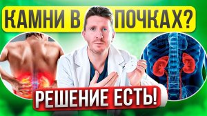 Как ускорить отхождение камней | Выведение камней из почек | Как облегчить выход камней из почек