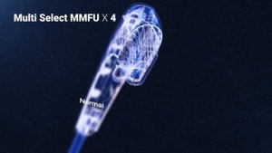 Ultraformer MPT ㅣ Micro Pulsed Technology of the new HIFU device