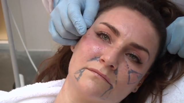 Restylane Fullface @ Atelier Restylane by Dr Berne смотреть онлайн