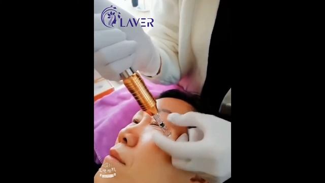 Hyaluron pen for eye lifting смотреть онлайн