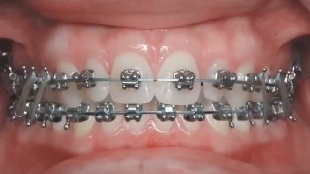 In Ovation смотреть онлайн