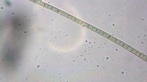 ЧТО МОЖНО УВИДЕТЬ В КАПЛЕ ВОДЫ С ОЗЕРА ПОД МИКРОСКОПОМ ЗА 1000$?