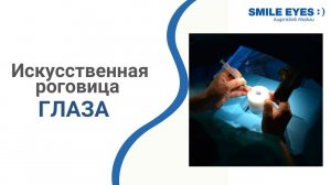 Искусственная роговица глаза  для пересадки - когда появится?
