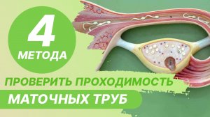 4️⃣ 4 метода исследования проходимости маточных труб