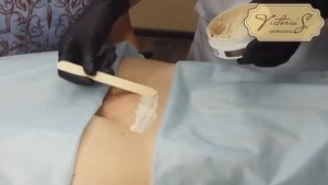 Удаление вросшего волоса и использование Маска Treatment MASK от Victoria's