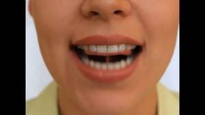 Артикуляционная гимнастика   Гармошка