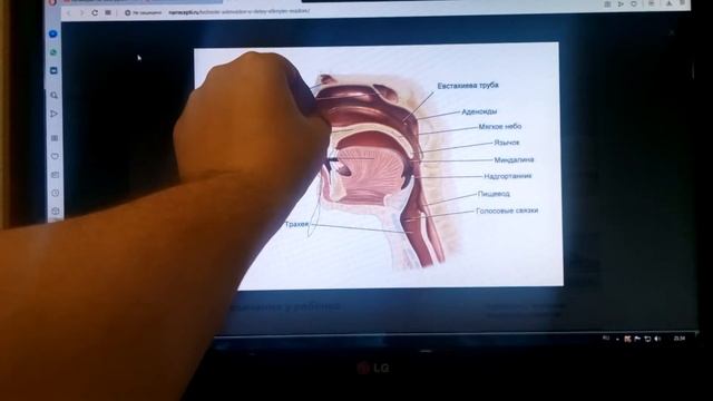 Как избавиться от храпа смотреть онлайн