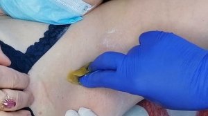 Подмышечные впадины. Женский шугаринг.