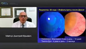 Особенности ведения пациентов с аденовирусным конъюнктивитом: теория и практика ДЮ Майчук