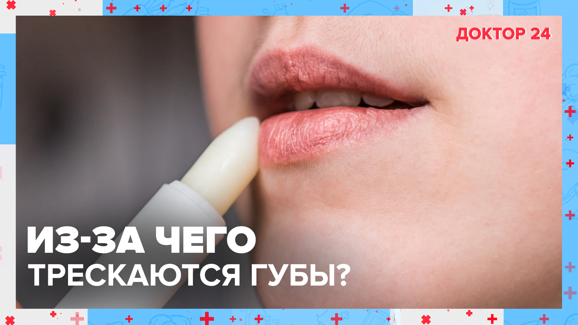 Почему в холодное время года часто трескаются ГУБЫ? | Доктор 24