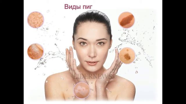 ➡️ ПИГМЕНТАЦИЯ   Что такое пигментация, причины, виды