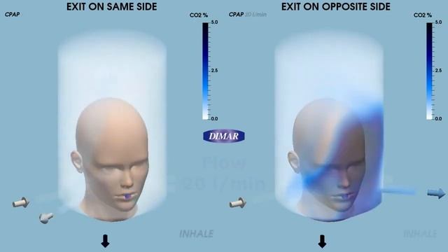Визуализация эффекта rebreathing (повторного вдыхания пациентом углекислого газа) в CPAP-шлеме Dima смотреть онлайн