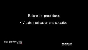 Удаление небных миндалин (гланд), Тонзиллэктомия.