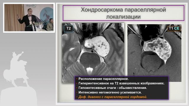 Андрей Мангов. Патология основания черепа. Клинические случаи смотреть онлайн