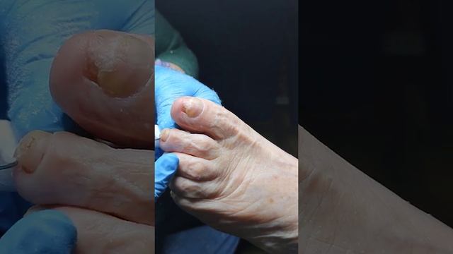 Работа с деформацией ногтей. смотреть онлайн