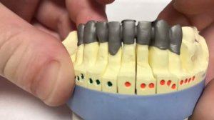 Литьё Зубов