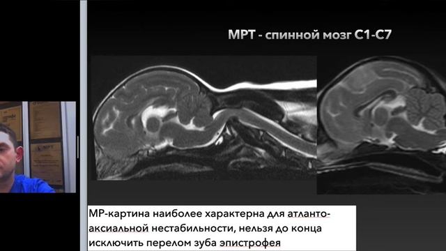 Атланто-аксиальная нестабильность у собаки смотреть онлайн