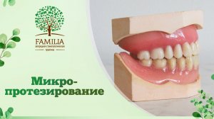 ? Микропротезирование